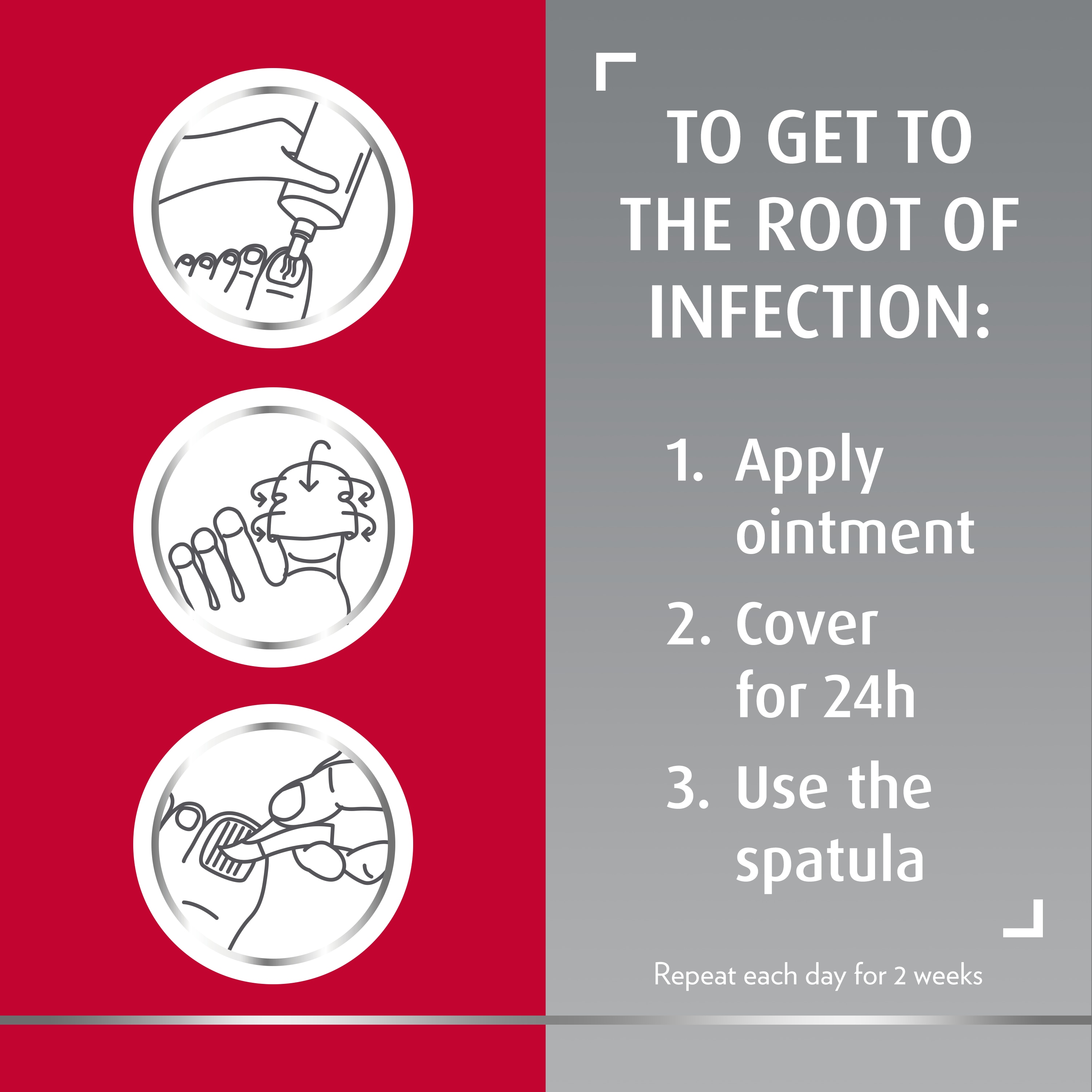 Canesten three-step fungal nail treatment icons, caption on right of picture: 1. Apply ointment 2. Cover for 24h 3. Use the spatula. Repeat every day for 2 weeks.